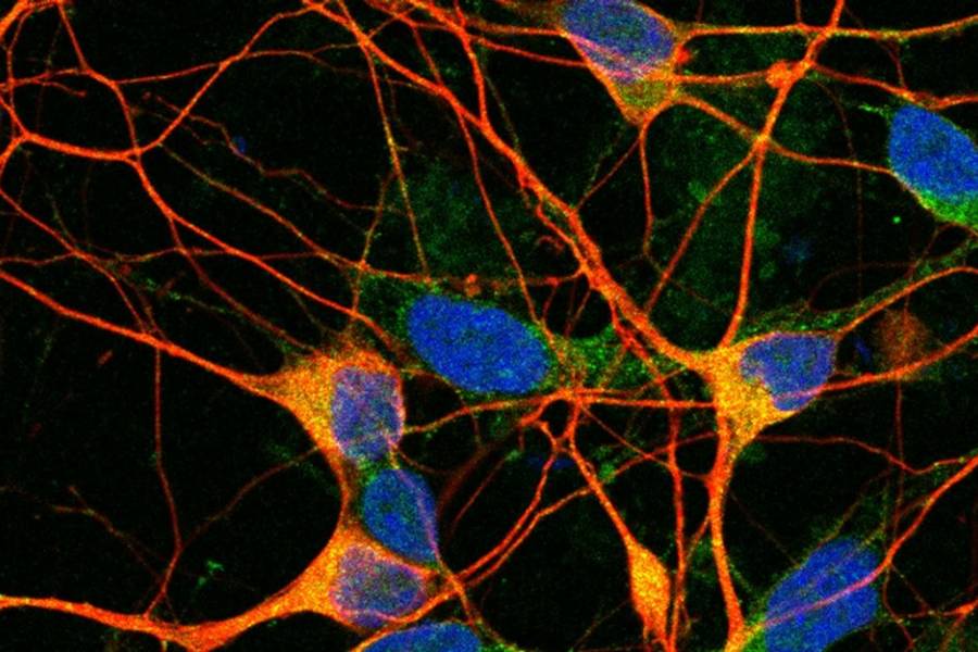 Científicos del CONICET reciben importante subsidio internacional para hallar tratamientos contra el Alzheimer