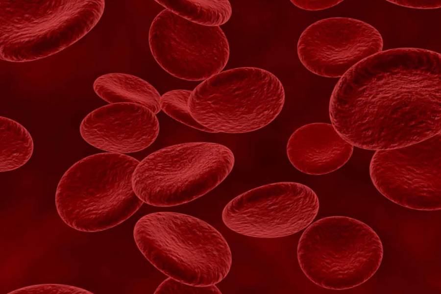 Cuando la anemia no es “solo anemia”: la señal que puede esconder un cáncer poco conocido de la médula ósea